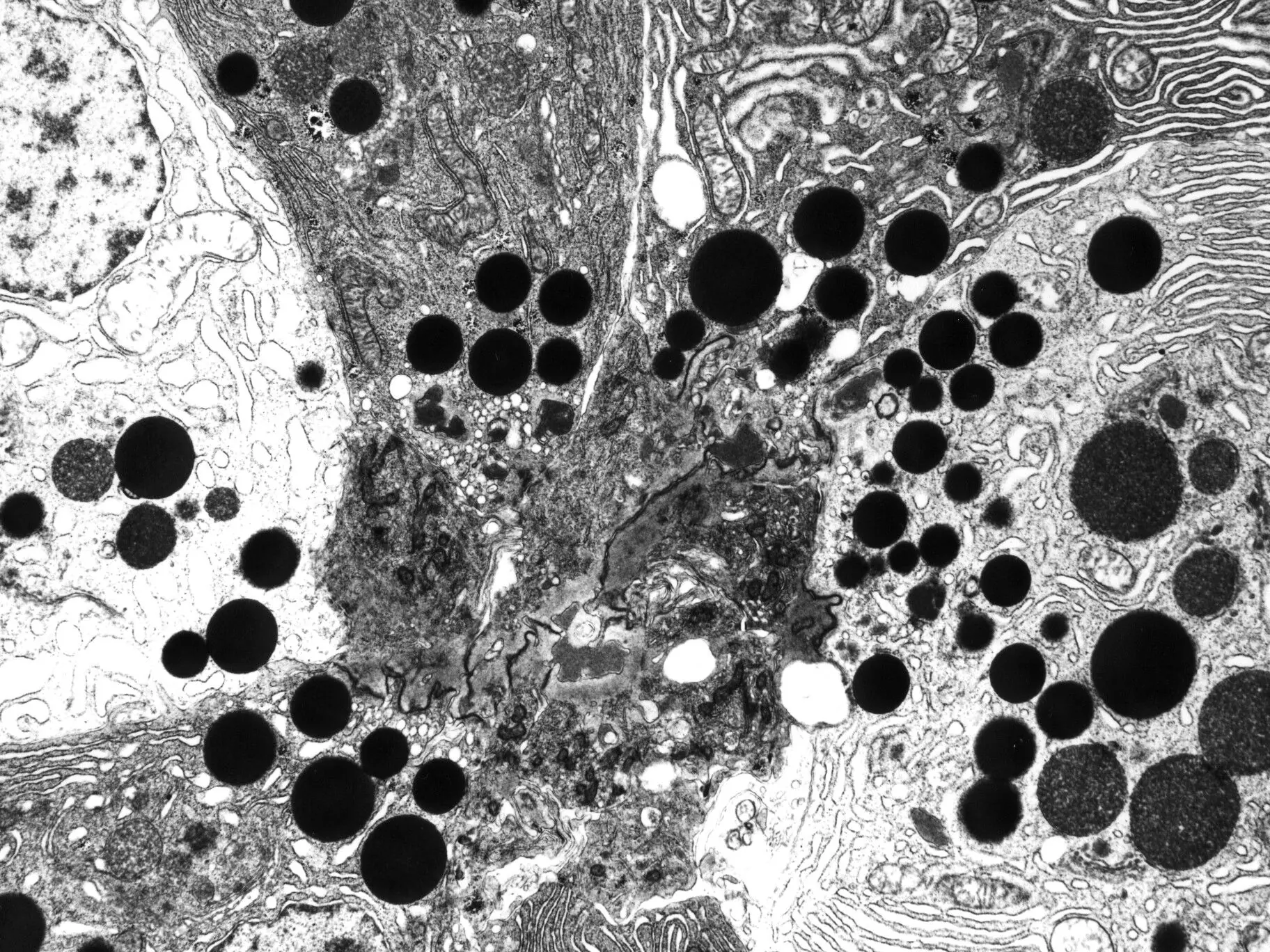 Zellen der Bauchspeicheldrüse mit Sekretkörnchen im Transmissionselektronenmikroskop