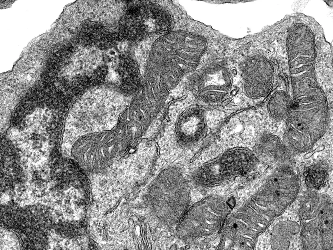 Normale Zelle mit Mitochondrien im Transmissionselektronenmikroskop